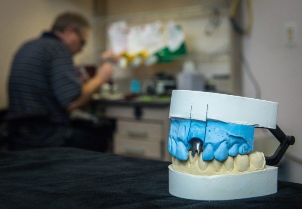 Dental models on the lab bench where appliances are checked